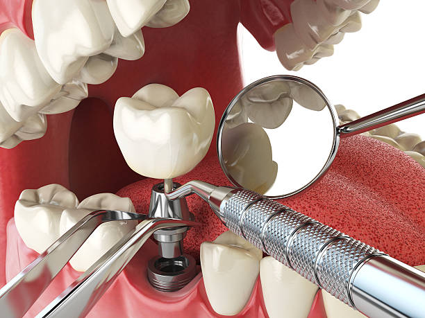 Best Emergency TMJ Treatment in Mount Vernon, IN