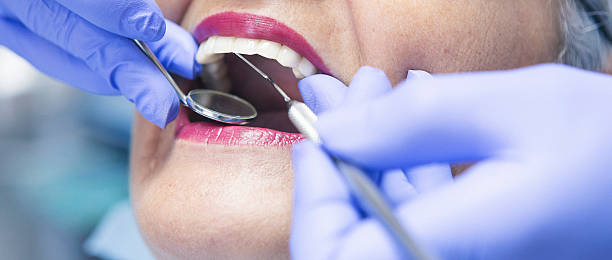 Best Emergency Dental Care for Broken or Chipped Teeth in Mount Vernon, IN